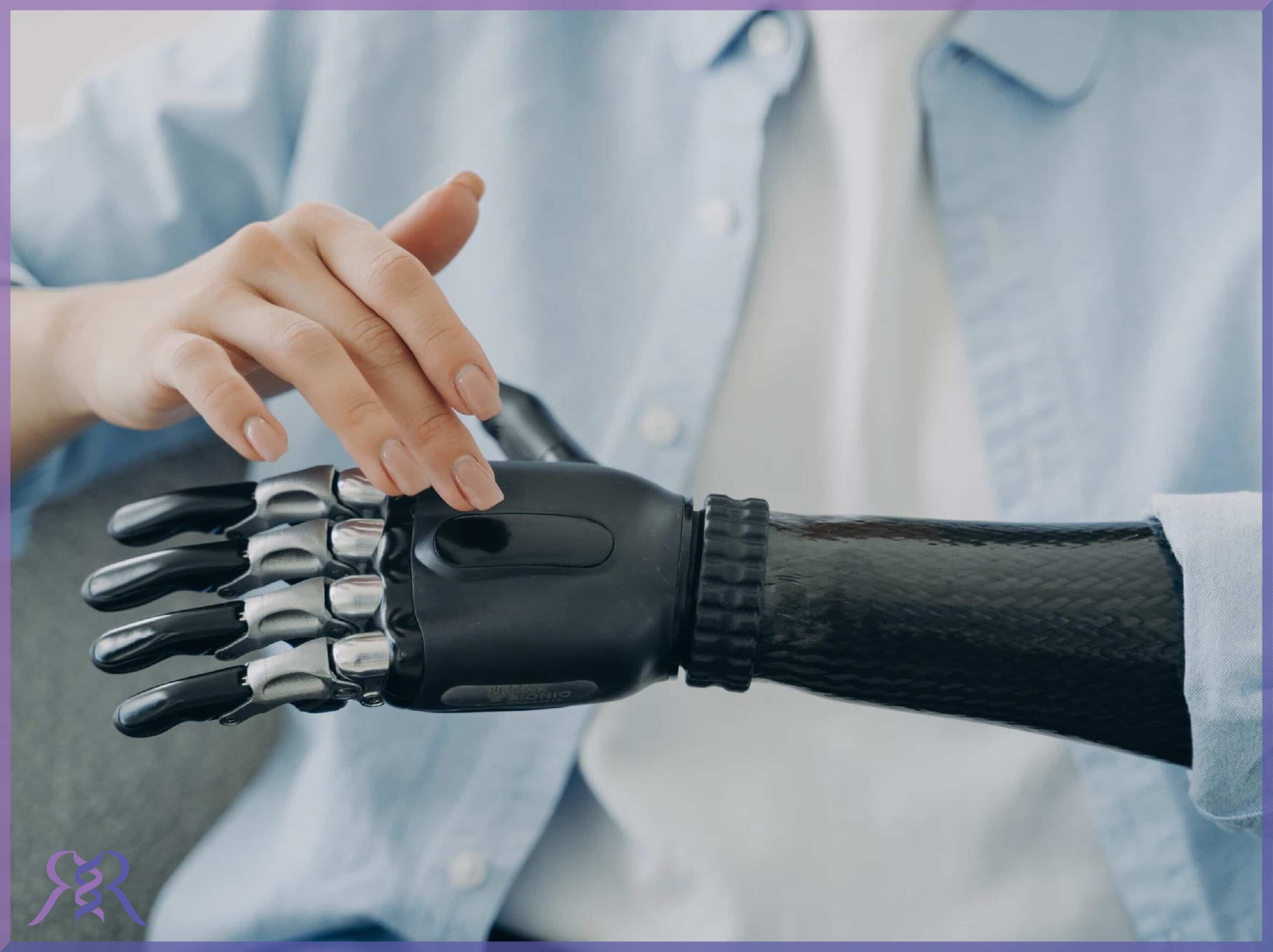 پروتز اندام فوقانی، فواید و معایب