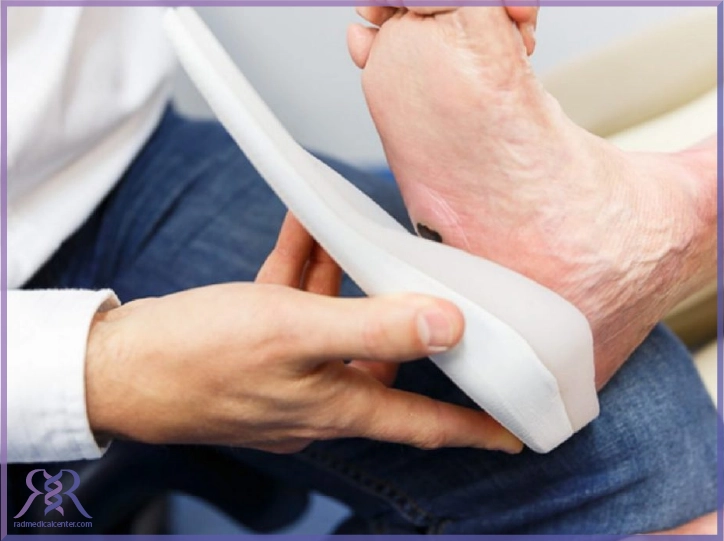 درمان کلاب فوت در بزرگسالی