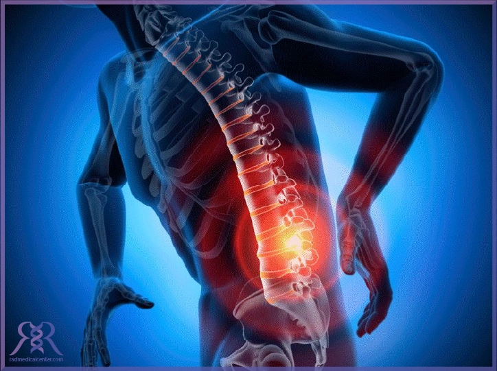 علت درد در ناحیه گودی کمر