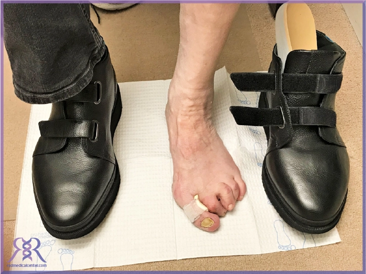 10 فایده استفاده از کفش های طبی