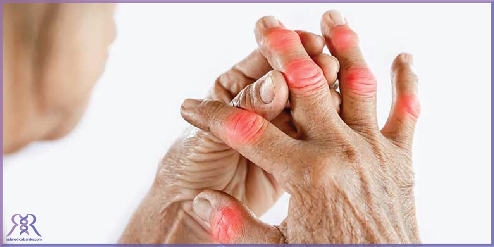 علل بروز آرتروز