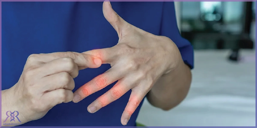 علت گز گز انگشتان دست