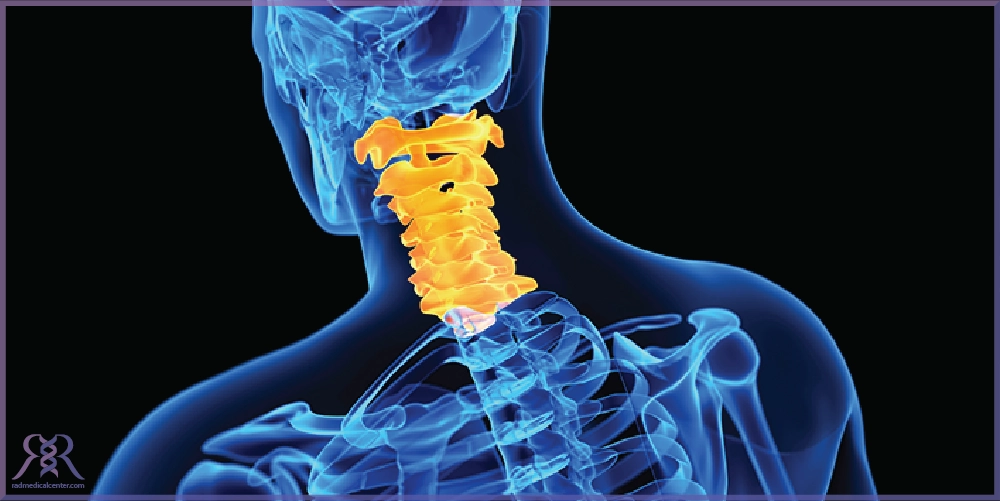 تشخیص بیماری دیسک گردن