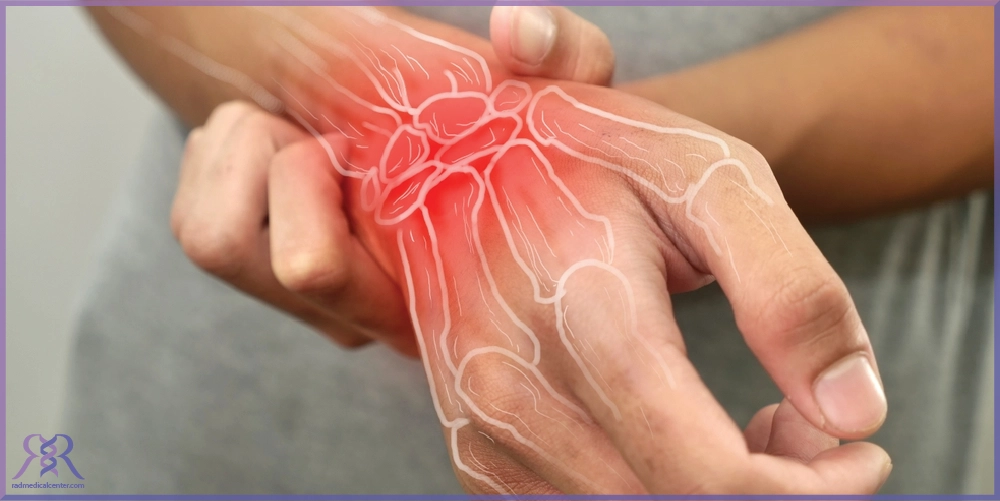 انواع آرتروز