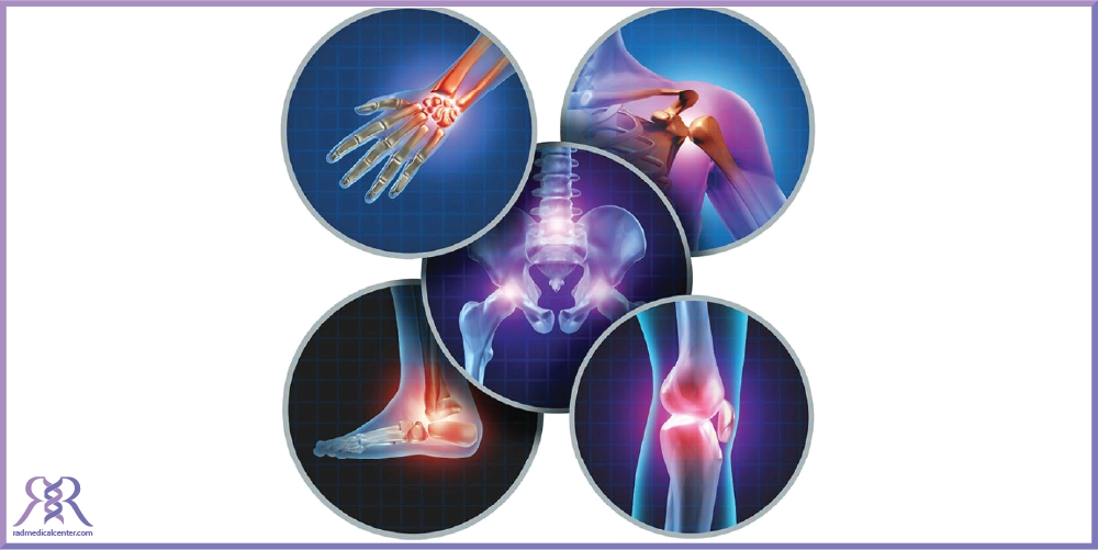 علل بروز آرتروز