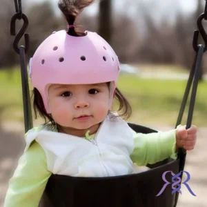 کرانیال هلمت (Cranial remolding helmets)
