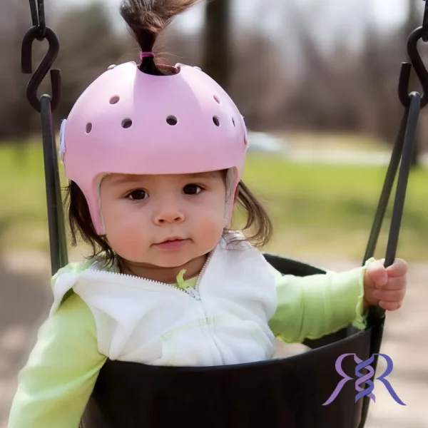 کرانیال هلمت (Cranial remolding helmets)