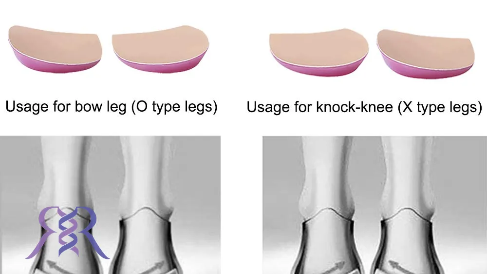 انواع کفی طبی