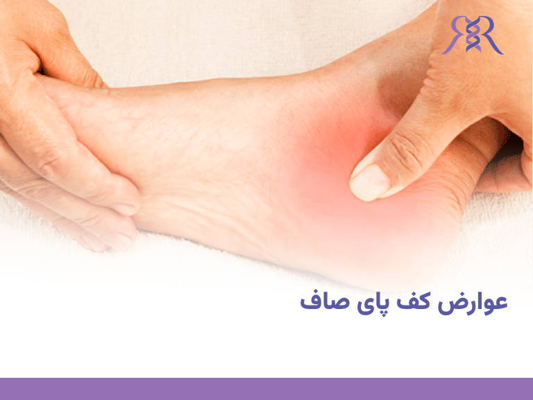عوارض کف پای صاف