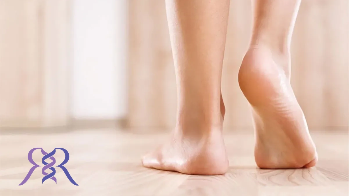 افتادگی مچ پا