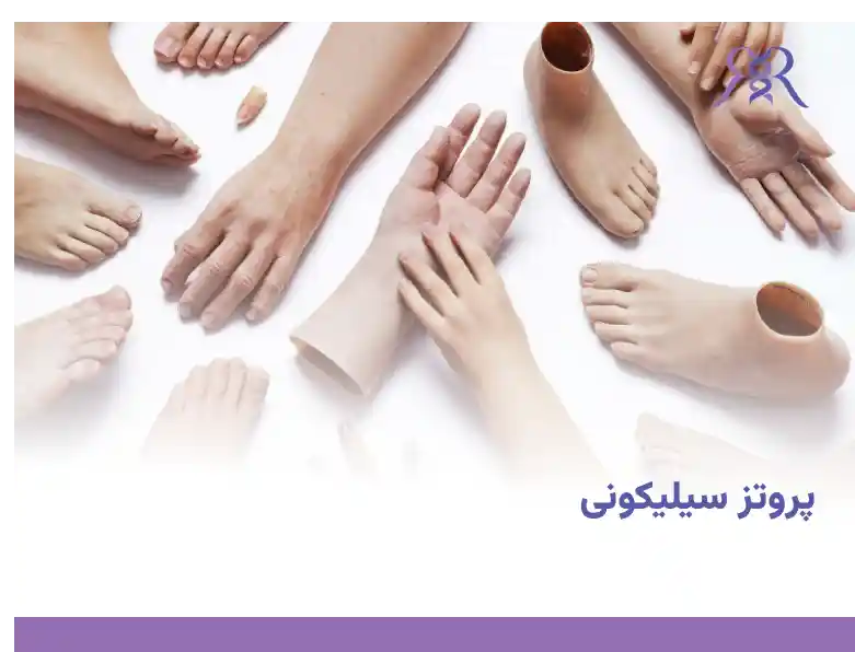پروتز سیلیکونی