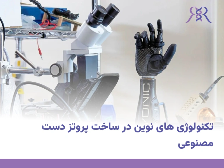 hand prosthesis manufacturing