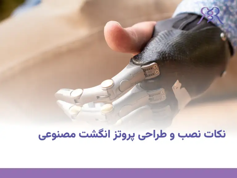 finger prosthetic installation