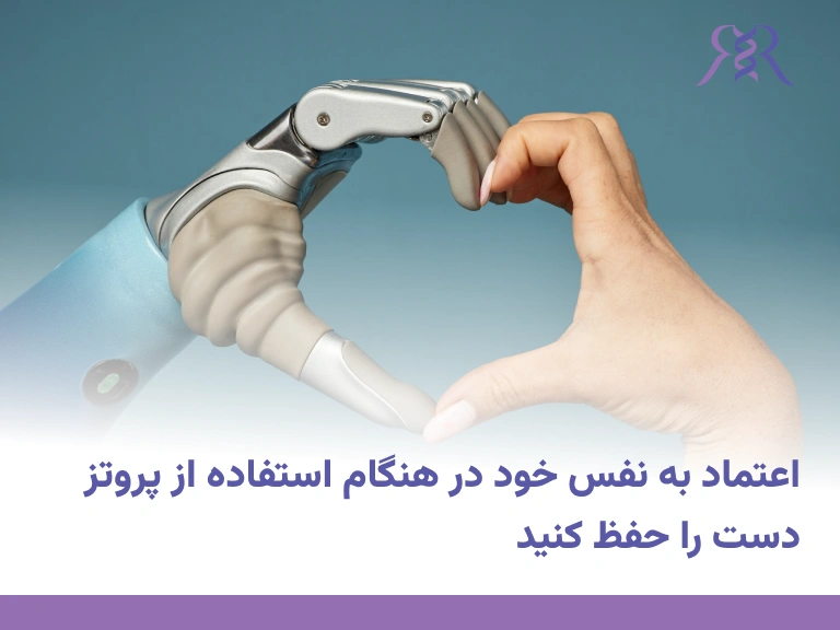 hand prosthetics