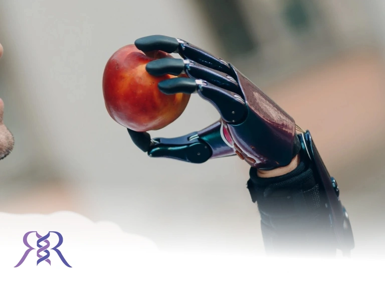 hand prosthesis manufacturing