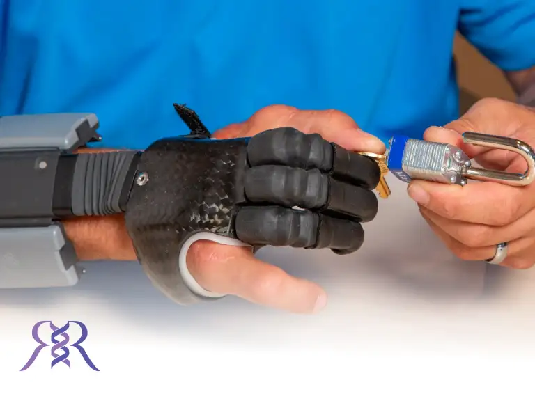 finger prosthetic installation