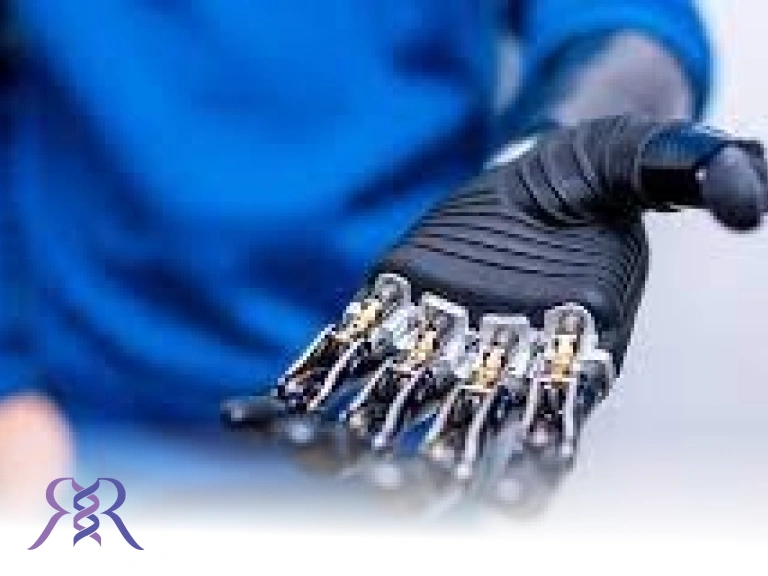 hand prosthesis manufacturing