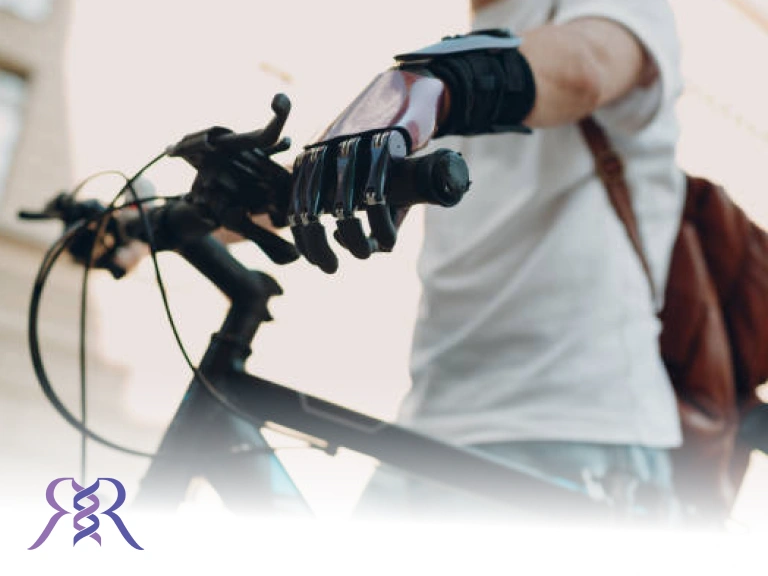 Sports for people with prosthetics