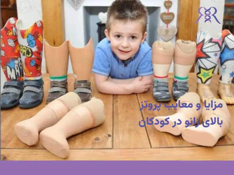 مزایا و معایب پروتز بالای زانو در کودکان