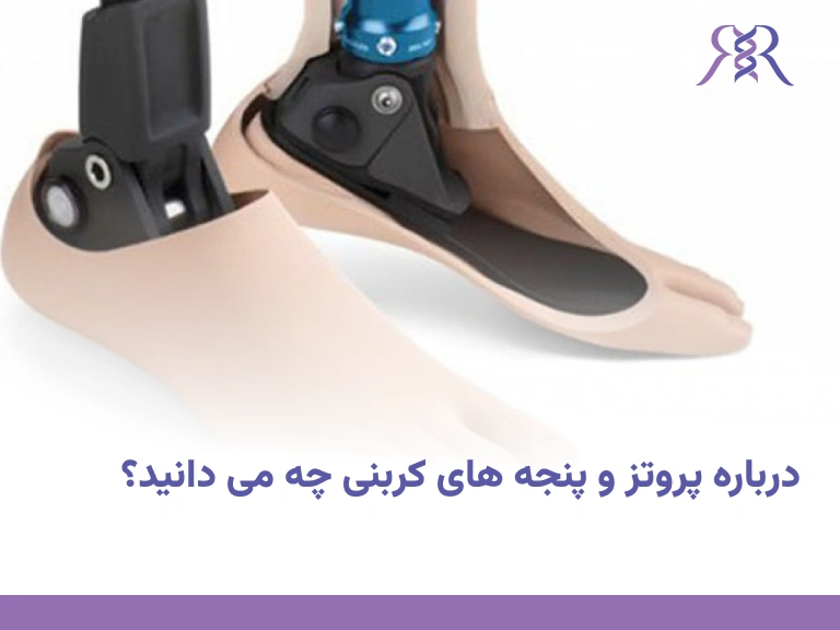 درباره پروتز و پنجه های کربنی چه می دانید؟