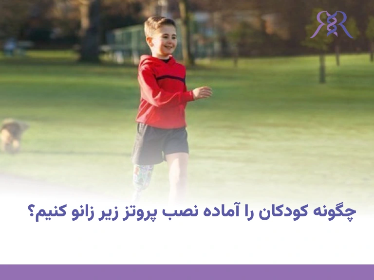 چگونه کودکان را آماده نصب پروتز زیر زانو کنیم؟