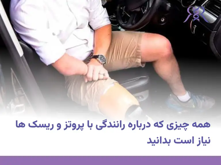همه چیزی که درباره رانندگی با پروتز و ریسک ها نیاز است بدانید
