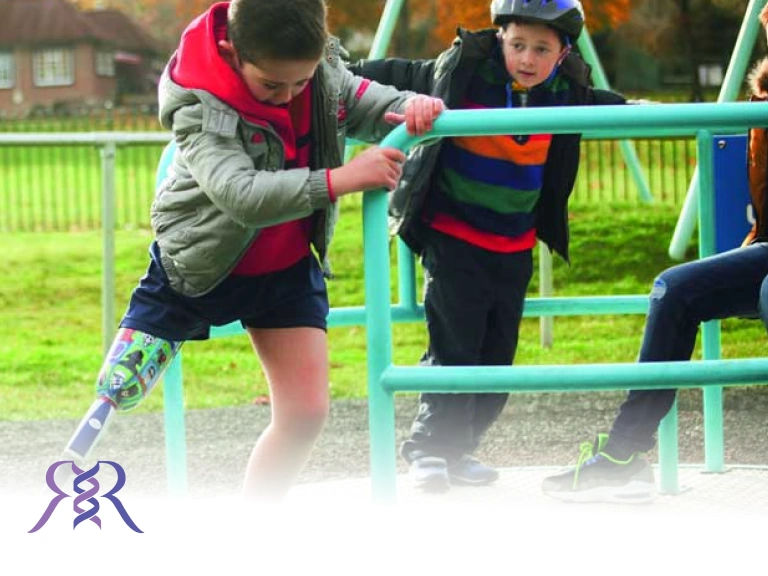 چگونه کودکان را آماده نصب پروتز زیر زانو کنیم؟