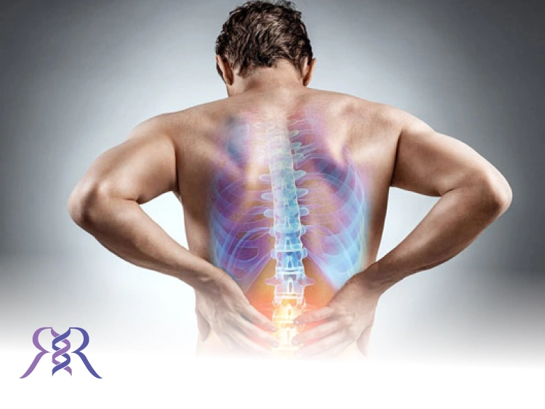 نشانه های اولیه بروز کمر درد را جدی بگیرید!