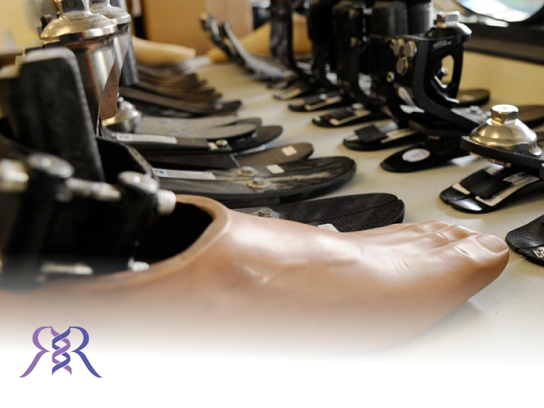 درباره پروتز و پنجه های کربنی چه می دانید؟