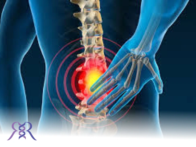 کمردرد و مشکلات ستون فقرات تحت تاثیر چاقی و اضافه وزن