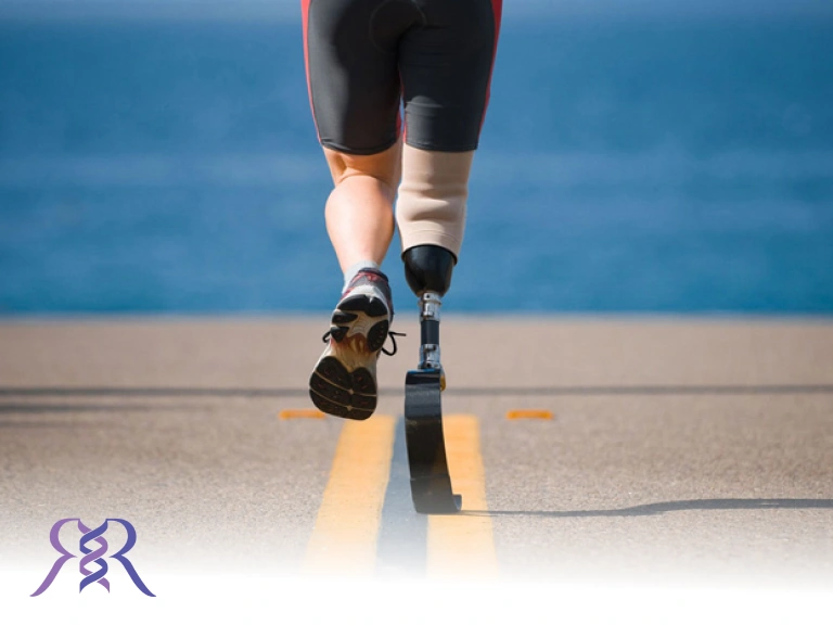 درباره پروتز و پنجه های کربنی چه می دانید؟