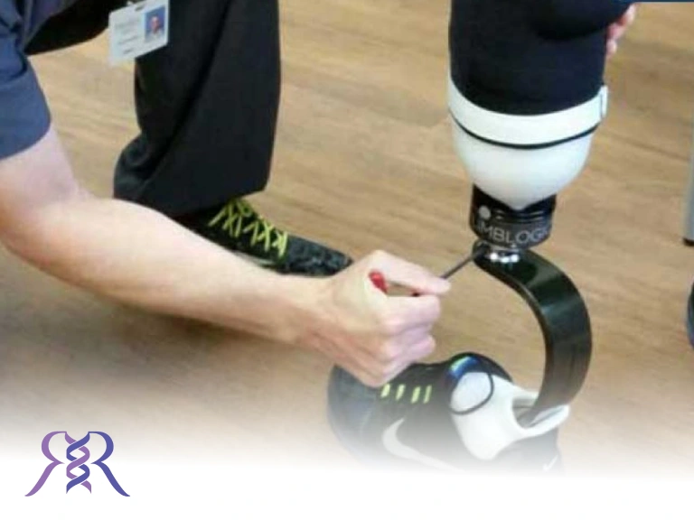 درباره پروتز و پنجه های کربنی چه می دانید؟