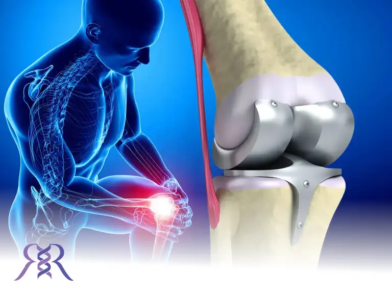 هر آن چه که باید در انتخاب پروتز بالای زانو رعایت کنید