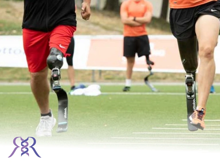 چگونه کودکان را آماده نصب پروتز زیر زانو کنیم؟