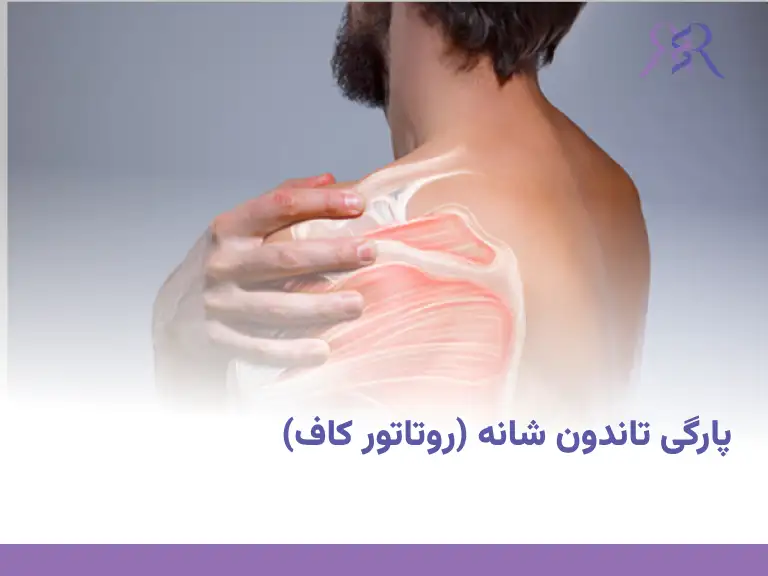 پارگی تاندون شانه (روتاتور کاف)