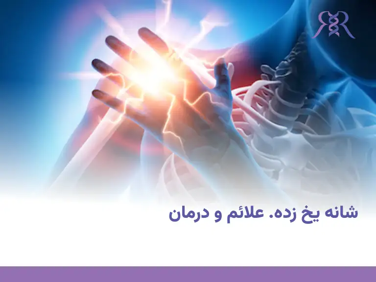 شانه یخ زده. علائم و درمان