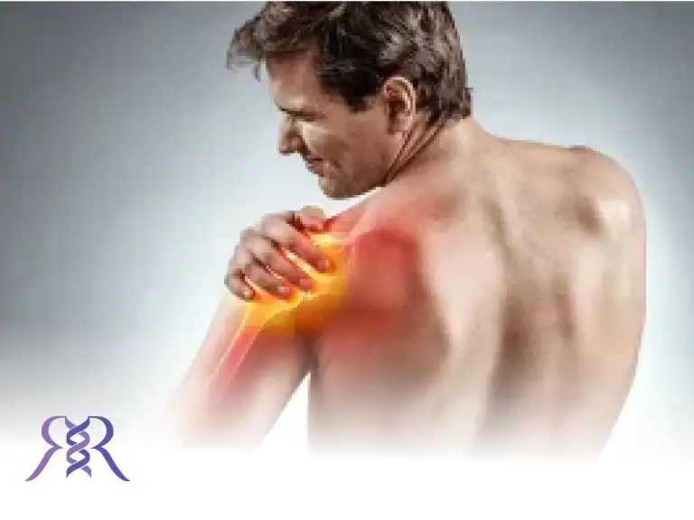 شانه یخ زده. علائم و درمان