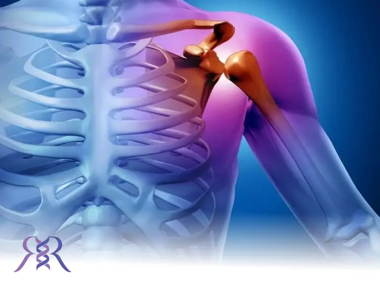 شانه یخ زده. علائم و درمان