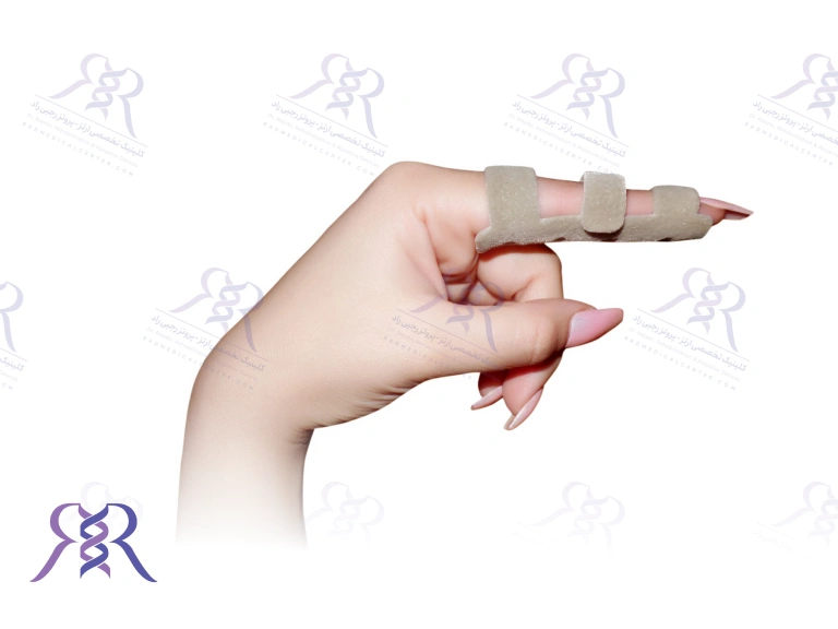 ارتز انگشتان دست