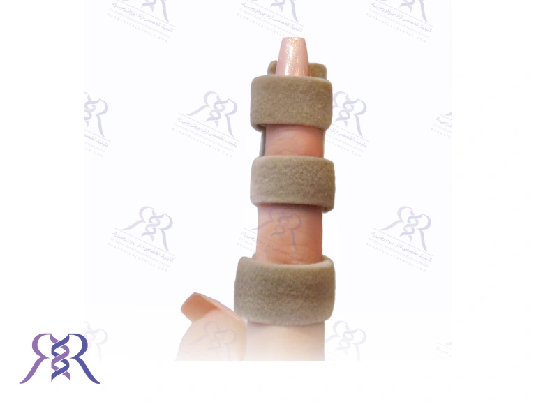 ارتز انگشتان دست