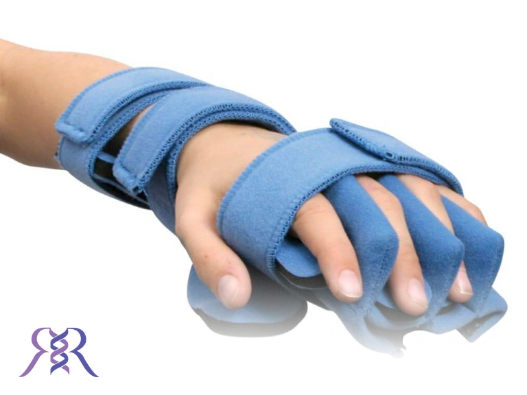 ارتز انگشتان دست