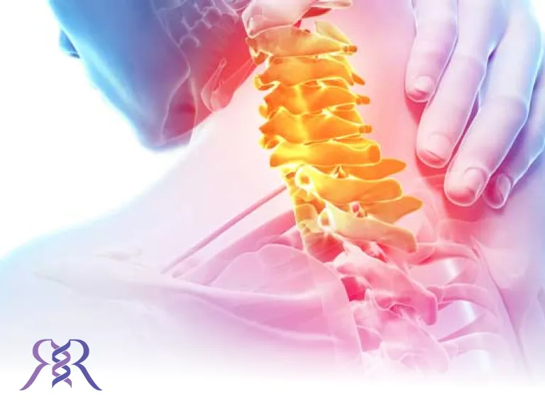 گردن درد | علت درد گردن چیست؟ + درمان با ارتز سر و گردن