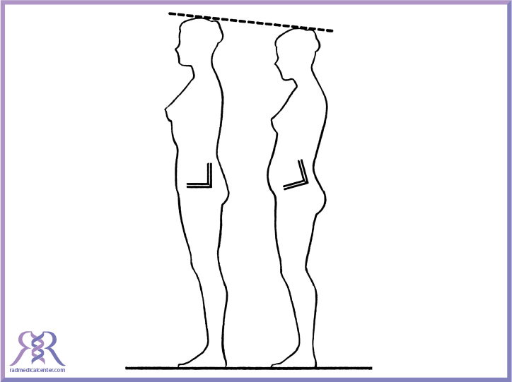 رفع گودی کمر و افزایش قد