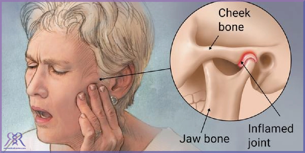درمان آرتروز فک چیست