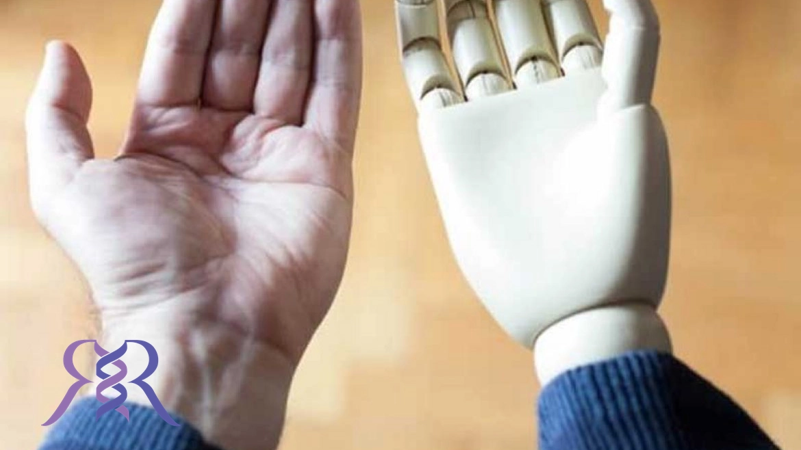 پروتز دست مصنوعی هوشمند