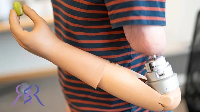 پروتز دست مصنوعی هوشمند