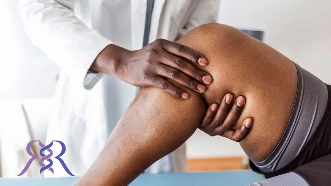 تعویض مفصل زانو