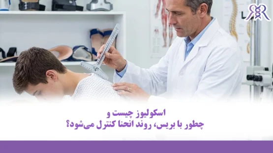 اسکولیوز چیست و چطور با بریس، روند انحنا کنترل می‌شود؟
