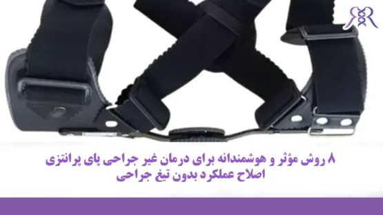 8 روش مؤثر و هوشمندانه برای درمان غیر جراحی پای پرانتزی | اصلاح عملکرد بدون تیغ جراحی