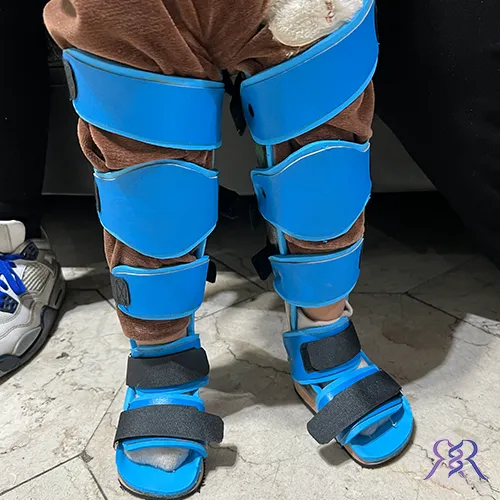 اسپلینت های تخصصی برای کودکان